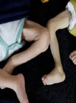 مسئول بیمارستان ناصر در غزه: جان هزاران کودک این باریکه در خطر است